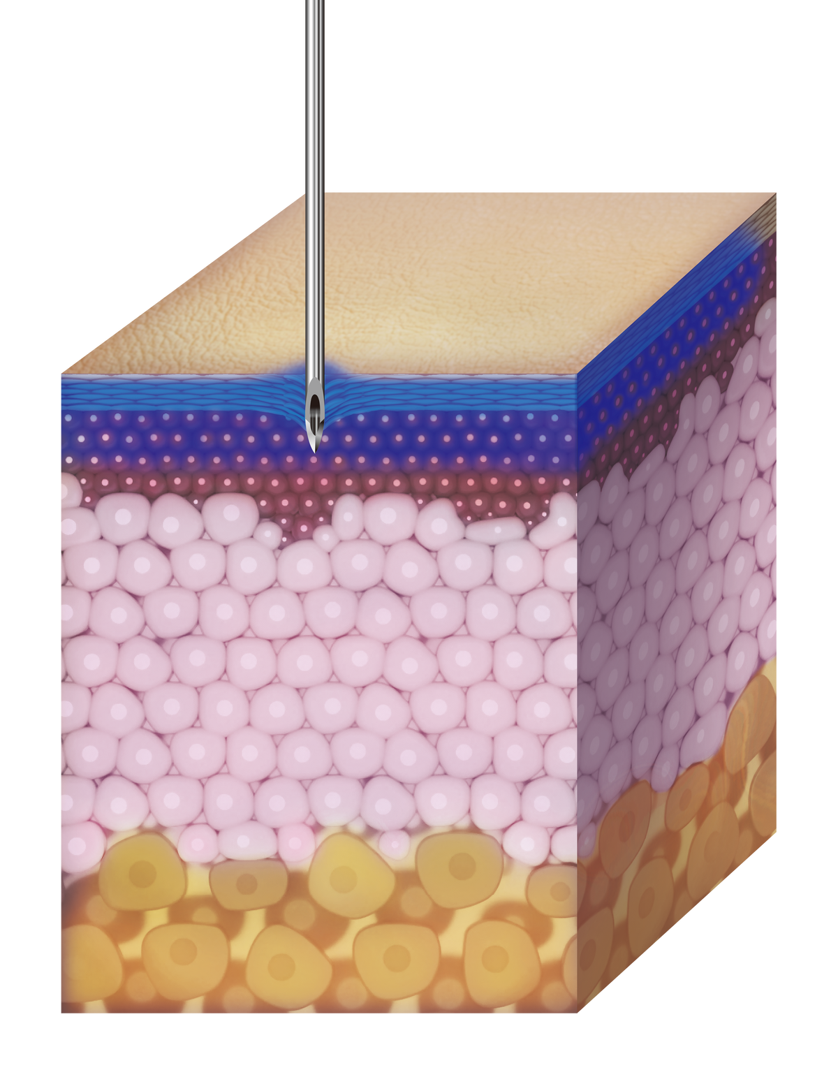 Turtlepin 0.5mm application depth