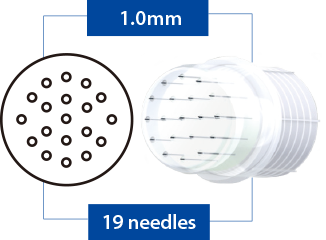 Turtlepin 19 pin – 1 mm Hypodermic needle cartridges (5/pck) thumbnail 3